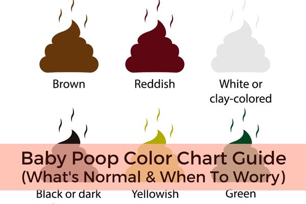 Baby Poop Color Chart Guide
